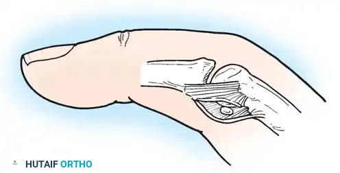 Hutaifortho's Orthopaedic Diagram