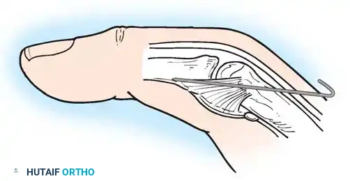 Hutaifortho's Orthopaedic Diagram