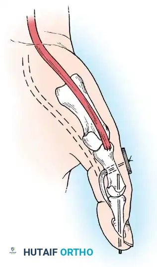 Hutaifortho's Orthopaedic Diagram