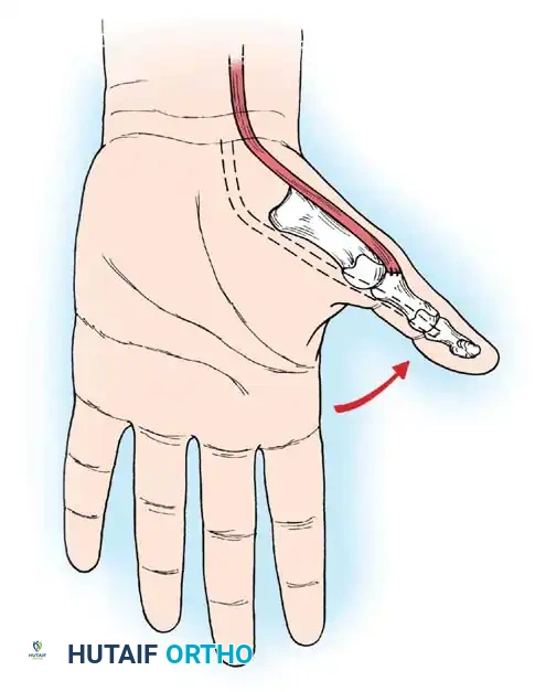 Hutaifortho's Orthopaedic Diagram