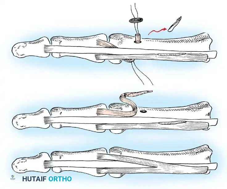 Hutaifortho's Orthopaedic Diagram