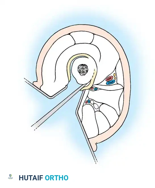 Hutaifortho's Orthopaedic Diagram