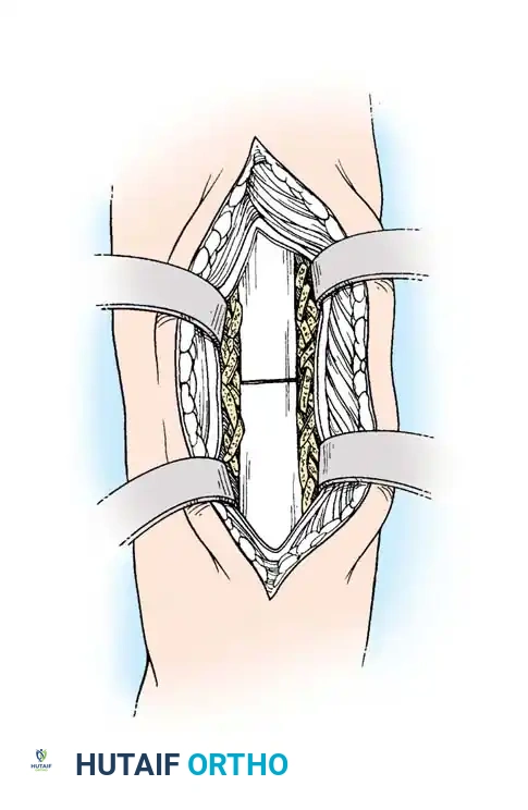 Hutaifortho's Orthopaedic Diagram