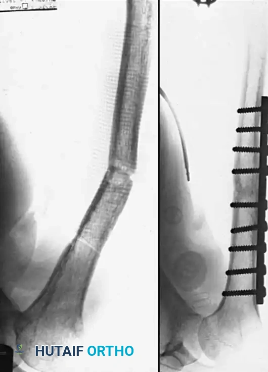 Hutaifortho's Orthopaedic Diagram