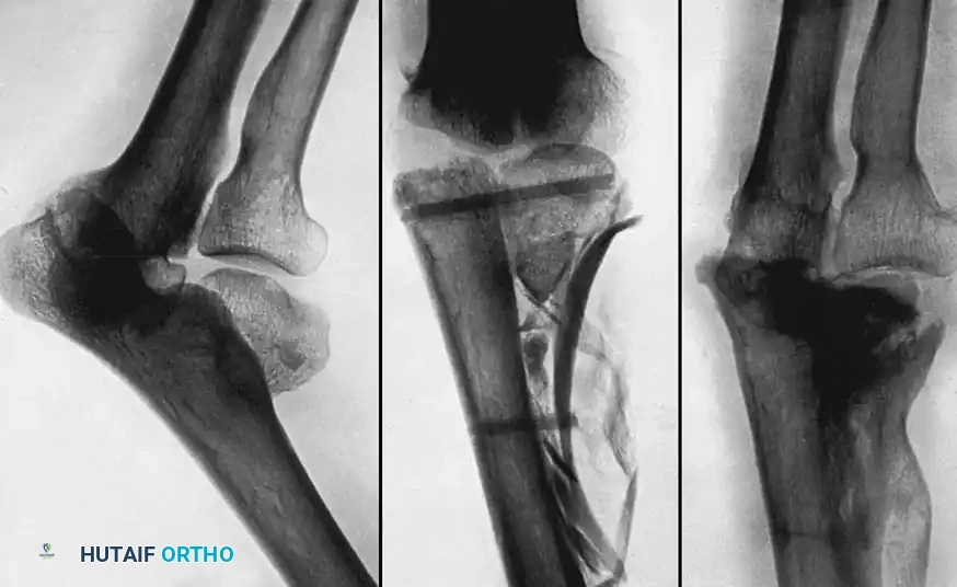 Hutaifortho's Orthopaedic Diagram