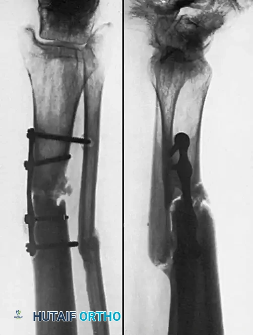 Hutaifortho's Orthopaedic Diagram