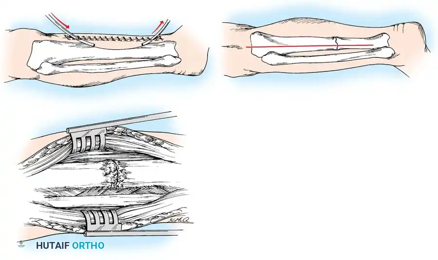 Hutaifortho's Orthopaedic Diagram