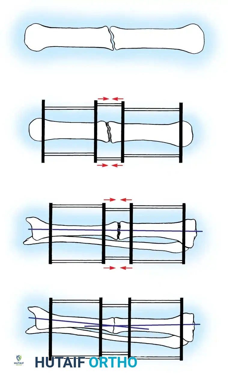 Hutaifortho's Orthopaedic Diagram