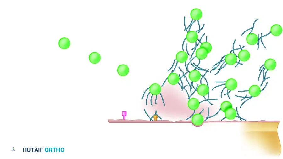 Illustration of soft tissue injury - Dr. Mohammed Hutaif