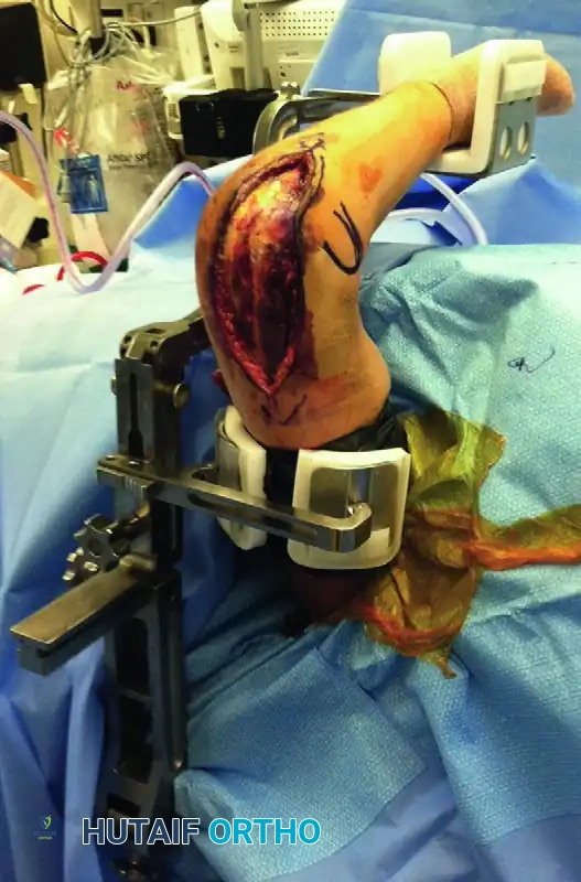 Thin-blade oscillating saw