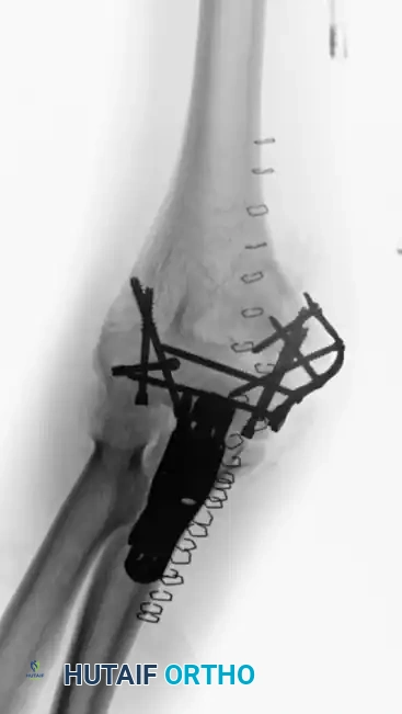 Arm holder for positioning