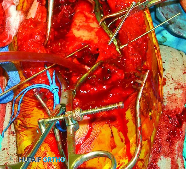 Alternative view of repair