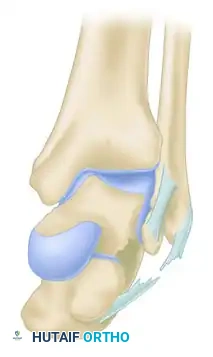 Neutral Eversion Inversion