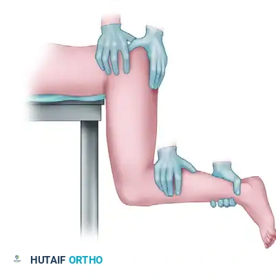 OPEN REDUCTION OF HIP DISLOCATION Surgical Diagram