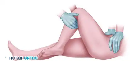 OPEN REDUCTION OF HIP DISLOCATION Surgical Diagram