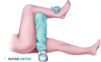 FIGURE 60-13 A, “East Baltimore lift” is shown with physician and assistant’s arms as fulcrum and ankle as lever. B, A second assistant stabilizes the pelvis.