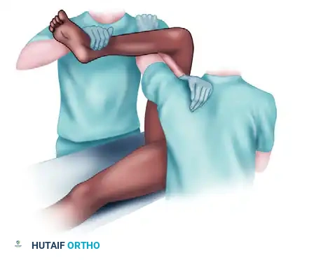 OPEN REDUCTION OF HIP DISLOCATION Surgical Diagram