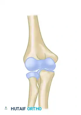 Reconstruction Step 3