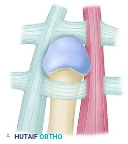 Masterclass in Open Reduction of Hand Dislocations: MCP and CMC Joints