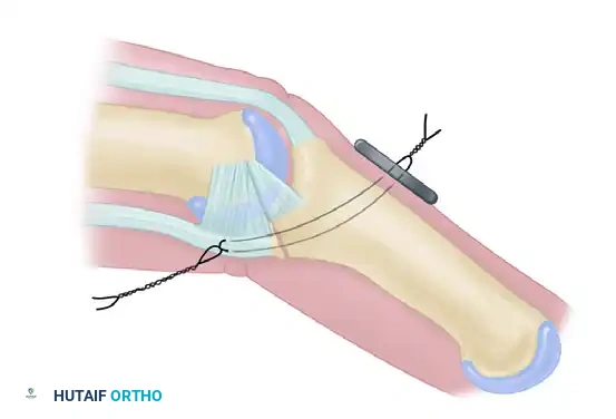 Hutaifortho's Orthopaedic Diagram