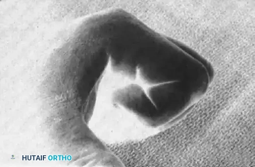 Hutaifortho's Orthopaedic Diagram