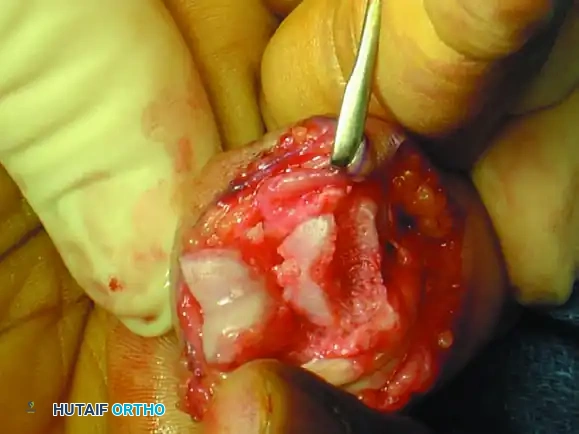 Hutaifortho's Orthopaedic Diagram