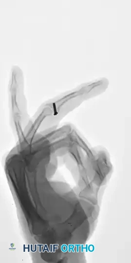 Hutaifortho's Orthopaedic Diagram