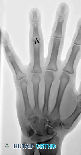 Hutaifortho's Orthopaedic Diagram