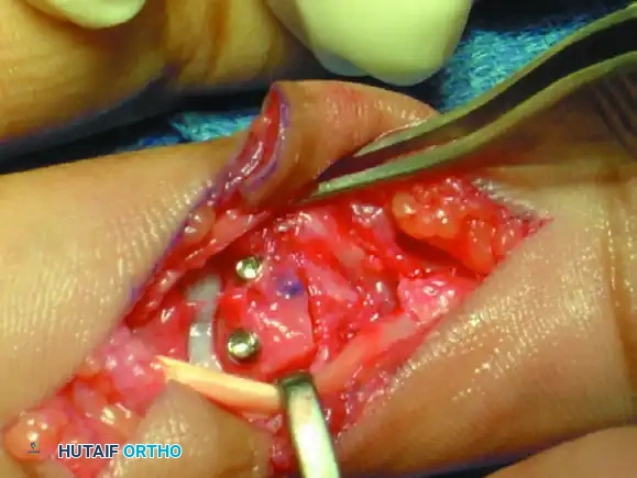 Hutaifortho's Orthopaedic Diagram