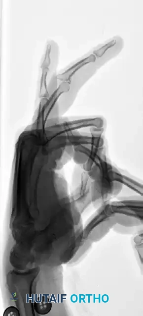 Hutaifortho's Orthopaedic Diagram