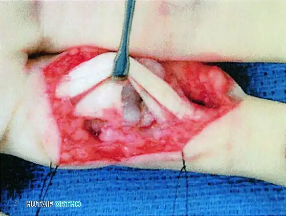 Hutaifortho's Orthopaedic Diagram