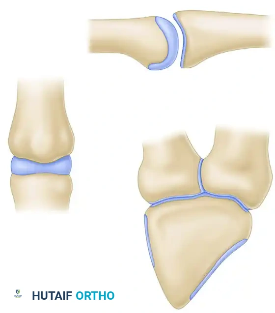 Hutaifortho's Orthopaedic Diagram