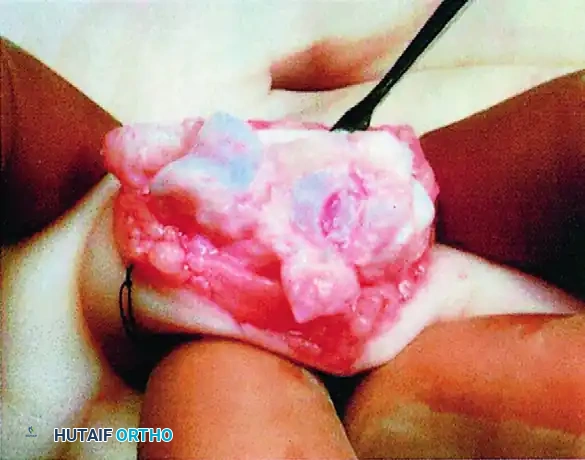 Hutaifortho's Orthopaedic Diagram