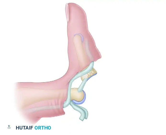 Hutaifortho's Orthopaedic Diagram