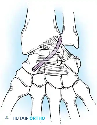 Hutaifortho's Orthopaedic Diagram