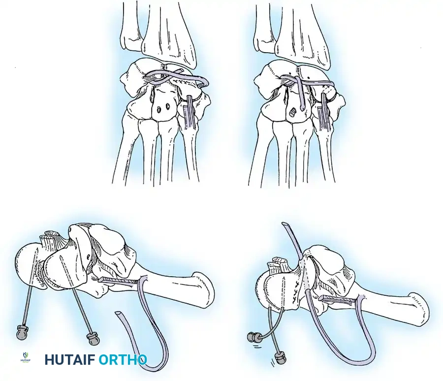 Hutaifortho's Orthopaedic Diagram