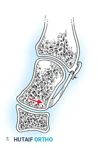 Hutaifortho's Orthopaedic Diagram