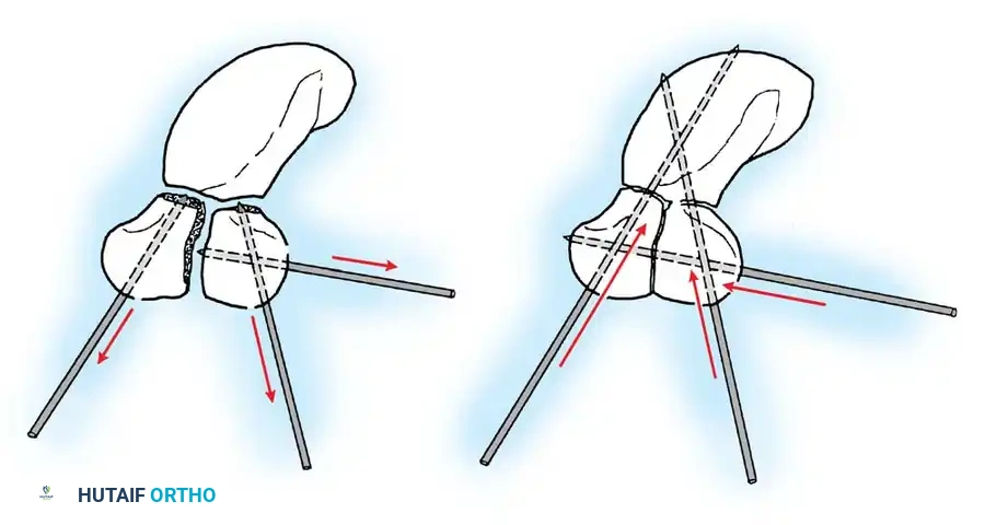 Hutaifortho's Orthopaedic Diagram