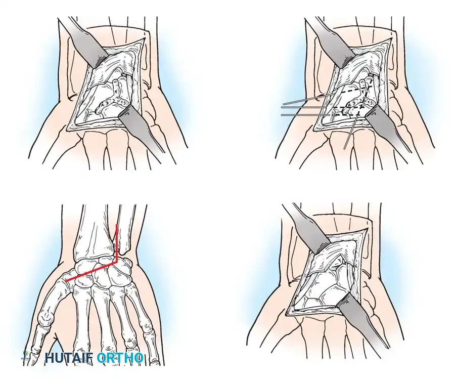 Hutaifortho's Orthopaedic Diagram