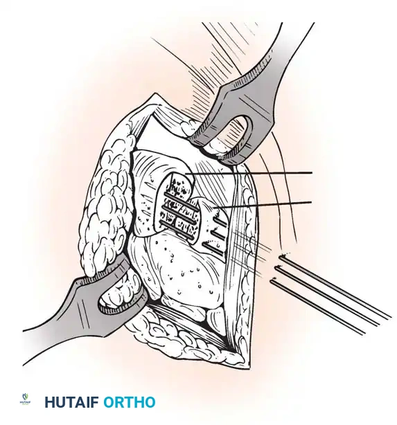 Hutaifortho's Orthopaedic Diagram