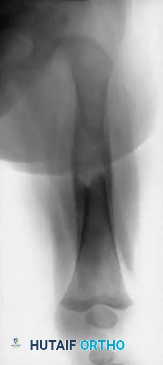 Hutaifortho's Orthopaedic Diagram