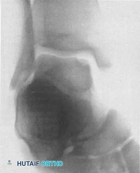 Hutaifortho's Orthopaedic Diagram