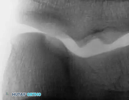 Hutaifortho's Orthopaedic Diagram