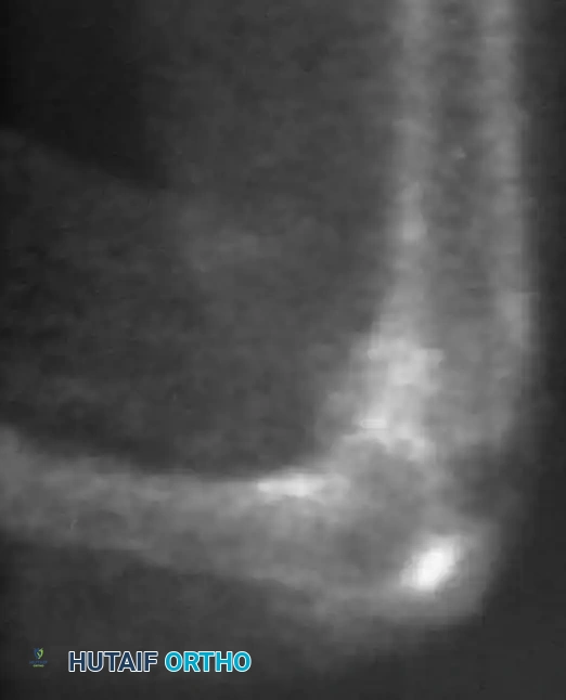 Hutaifortho's Orthopaedic Diagram