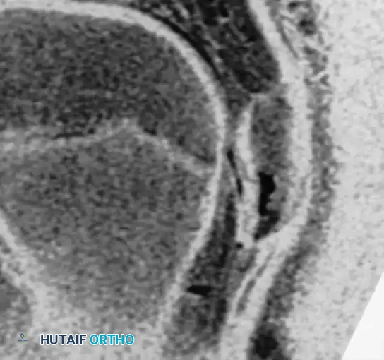 Hutaifortho's Orthopaedic Diagram