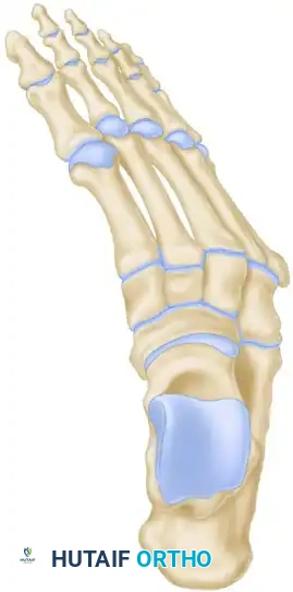 OSTEOTOMY OF THE CALCANEUS Surgical Diagram