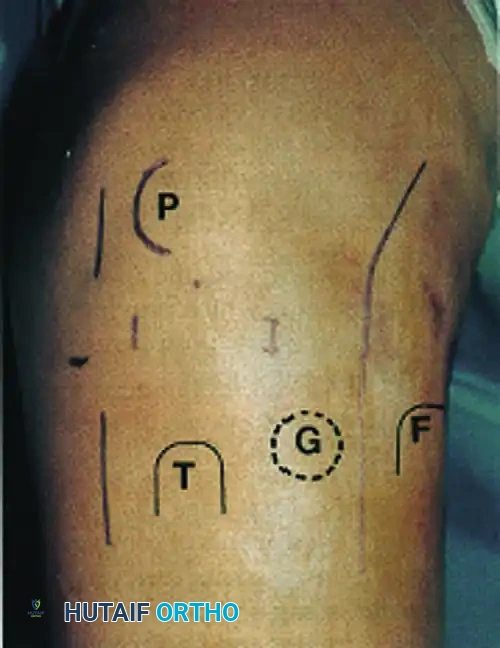 OTHER ASSOCIATED INJURIES Surgical Diagram
