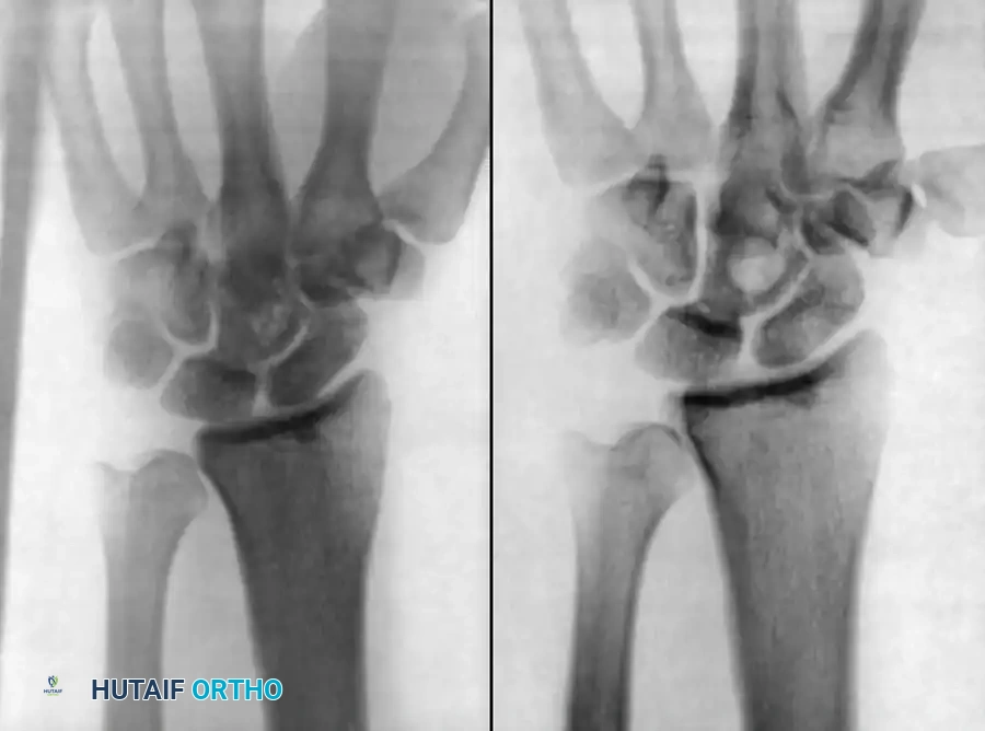 Unusual Musculoskeletal Infections: Comprehensive Surgical Management