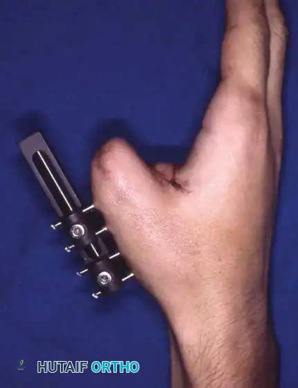 Hutaifortho's Orthopaedic Diagram