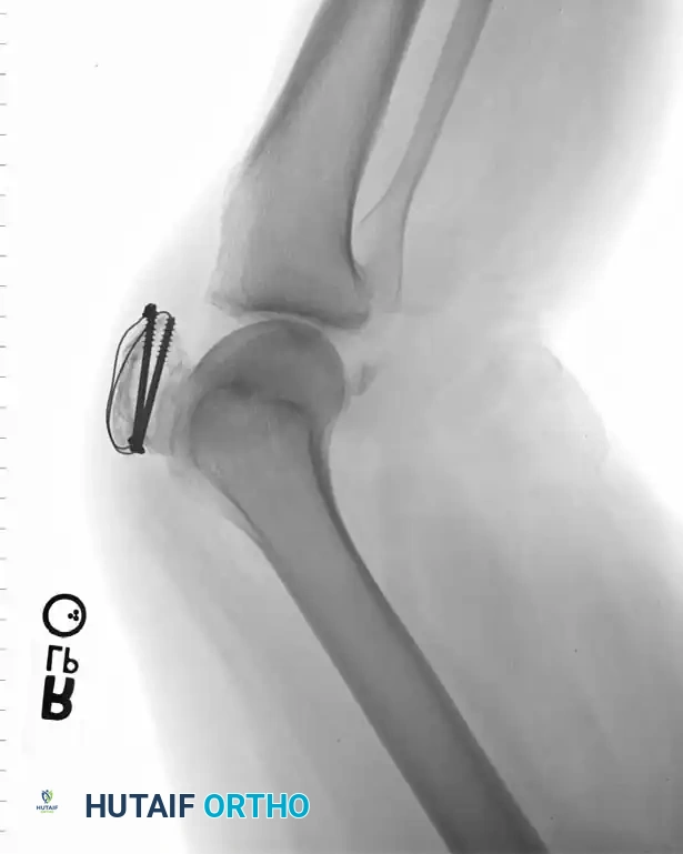 Hutaifortho's Orthopaedic Diagram